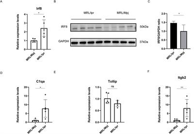 Comprehensive analysis of IRF8-related genes and immune characteristics in lupus nephritis